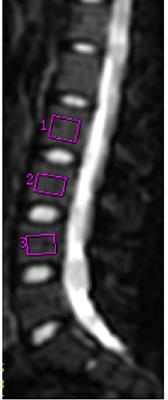 Study of bone marrow microstructure in healthy young adults using intravoxel incoherent motion diffusion-weighted MRI